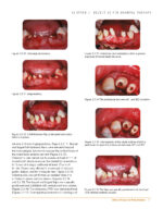 Clinical Cases in Periodontics 2022 (2nd Edition) - Image 4