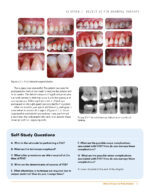 Clinical Cases in Periodontics 2022 (2nd Edition) - Image 5