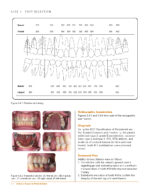 Clinical Cases in Periodontics 2022 (2nd Edition) - Image 6