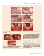 Clinical Cases in Periodontics 2022 (2nd Edition) - Image 7