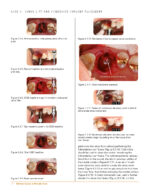 Clinical Cases in Periodontics 2022 (2nd Edition) - Image 9