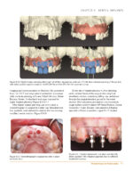 Clinical Cases in Periodontics 2022 (2nd Edition) - Image 10