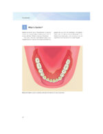 Everyone Can Achieve SUCTION-EFFECTIVE Mandibular Complete Denture 2020 - Image 9