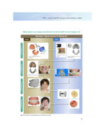 Everyone Can Achieve SUCTION-EFFECTIVE Mandibular Complete Denture 2020 - Image 7