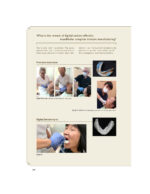 Everyone Can Achieve SUCTION-EFFECTIVE Mandibular Complete Denture 2020 - Image 4