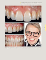 Techniques for Success with Implants in the Esthetic Zone 2019 - Image 2