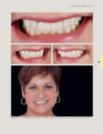 Techniques for Success with Implants in the Esthetic Zone 2019 - Image 5