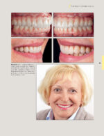 Techniques for Success with Implants in the Esthetic Zone 2019 - Image 6