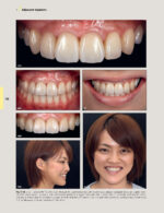 Techniques for Success with Implants in the Esthetic Zone 2019 - Image 13