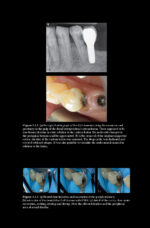 Pitt Ford’s Problem-Based Learning in Endodontology 2025 ( 2nd Edition) - Image 2