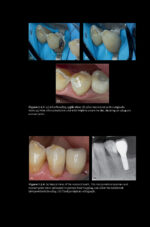Pitt Ford’s Problem-Based Learning in Endodontology 2025 ( 2nd Edition) - Image 4