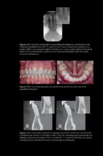 Pitt Ford’s Problem-Based Learning in Endodontology 2025 ( 2nd Edition) - Image 5