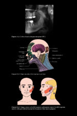 Pitt Ford’s Problem-Based Learning in Endodontology 2025 ( 2nd Edition) - Image 6