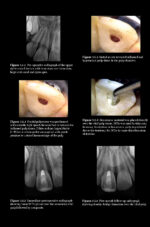 Pitt Ford’s Problem-Based Learning in Endodontology 2025 ( 2nd Edition) - Image 7