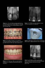 Pitt Ford’s Problem-Based Learning in Endodontology 2025 ( 2nd Edition) - Image 8