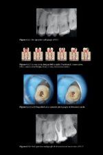 Pitt Ford’s Problem-Based Learning in Endodontology 2025 ( 2nd Edition) - Image 9
