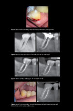 Pitt Ford’s Problem-Based Learning in Endodontology 2025 ( 2nd Edition) - Image 11