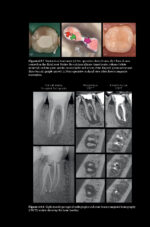 Pitt Ford’s Problem-Based Learning in Endodontology 2025 ( 2nd Edition) - Image 12