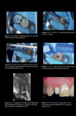 Pitt Ford’s Problem-Based Learning in Endodontology 2025 ( 2nd Edition) - Image 13