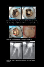 Pitt Ford’s Problem-Based Learning in Endodontology 2025 ( 2nd Edition) - Image 14