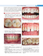 Textbook of OPERATIVE DENTISTRY  4th Edition  2020 - Image 5