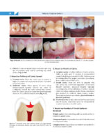 Textbook of OPERATIVE DENTISTRY  4th Edition  2020 - Image 6