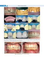 Textbook of OPERATIVE DENTISTRY  4th Edition  2020 - Image 8