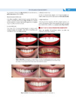Textbook of OPERATIVE DENTISTRY  4th Edition  2020 - Image 3