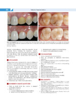 Textbook of OPERATIVE DENTISTRY  4th Edition  2020 - Image 9