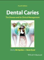 Dental Caries The Disease and Its Clinical Management 2025 (Fourth Edition)