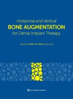 Horizontal and Vertical BONE AUGMENTATION for Dental Implant Therapy 2024
