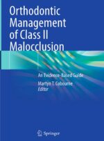 Orthodontic Management of Class II Malocclusion: An Evidence-Based Guide 2024