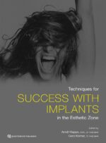 Techniques for Success with Implants in the Esthetic Zone 2019