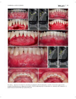 JERD: Journal of Esthetic and Restorative Dentistry 2023 - Image 11