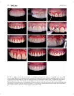 JERD: Journal of Esthetic and Restorative Dentistry 2023 - Image 12