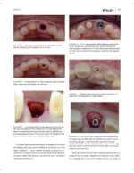 JERD: Journal of Esthetic and Restorative Dentistry 2023 - Image 13