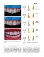 JERD: Journal of Esthetic and Restorative Dentistry 2023 - Image 3