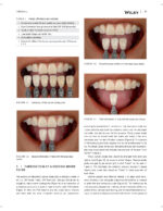 JERD: Journal of Esthetic and Restorative Dentistry 2023 - Image 4