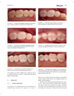 JERD: Journal of Esthetic and Restorative Dentistry 2023 - Image 7