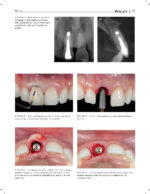 JERD: Journal of Esthetic and Restorative Dentistry 2023 - Image 9