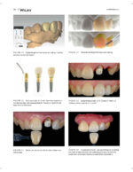 JERD: Journal of Esthetic and Restorative Dentistry 2023 - Image 10