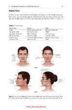 Gender Affirming Surgery of the Face and Neck 2025 - Image 14