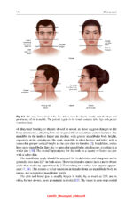 Gender Affirming Surgery of the Face and Neck 2025 - Image 3