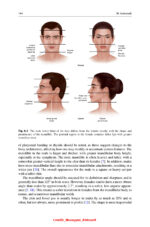 Gender Affirming Surgery of the Face and Neck 2025 - Image 3
