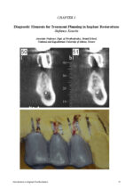 Introduction to Implant Prosthodontics: A case-based Clinical Guide 2022 - Image 4