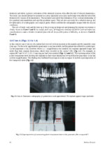 Introduction to Implant Prosthodontics: A case-based Clinical Guide 2022 - Image 5