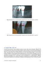 Introduction to Implant Prosthodontics: A case-based Clinical Guide 2022 - Image 6