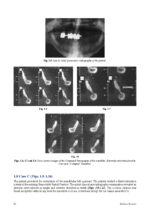 Introduction to Implant Prosthodontics: A case-based Clinical Guide 2022 - Image 7