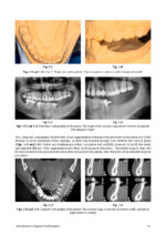 Introduction to Implant Prosthodontics: A case-based Clinical Guide 2022 - Image 8