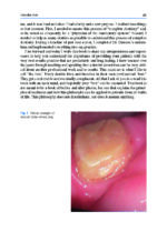 Functional Aesthetic Dentistry: How to Achieve Predictable Aesthetic Results Using Principles of a Stable Occlusion 2020 - Image 2